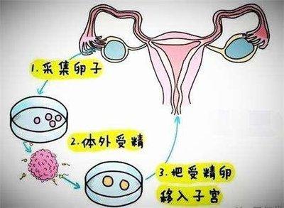 借卵生子是什么意思_借卵生子的含义是什么？